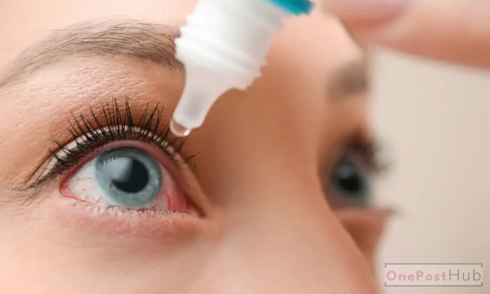 how to Cure Dry Eyes Permanently