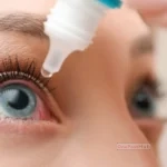 how to Cure Dry Eyes Permanently