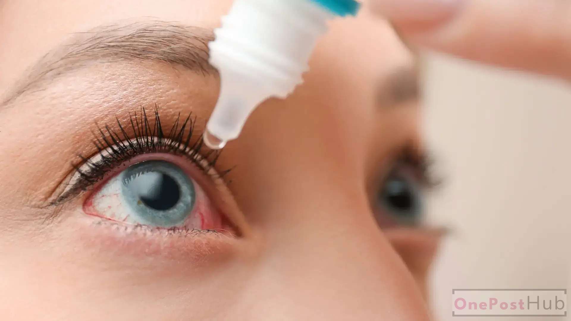 how to Cure Dry Eyes Permanently